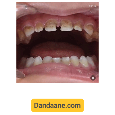 نمونه کار دیگری از دکتر نرجس امیری طهرانی