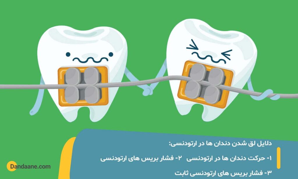علت لق شدن دندان در ارتودنسی
