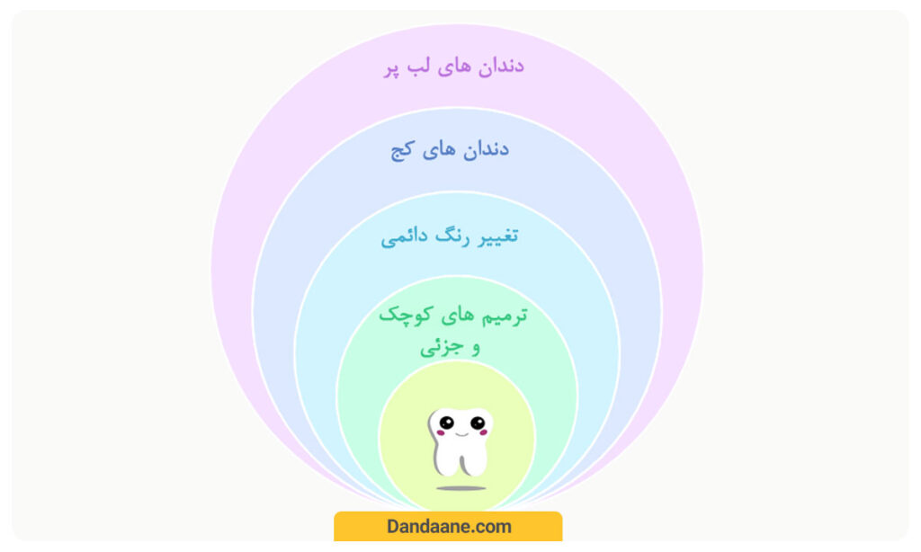کاربرد باندینگ دندان