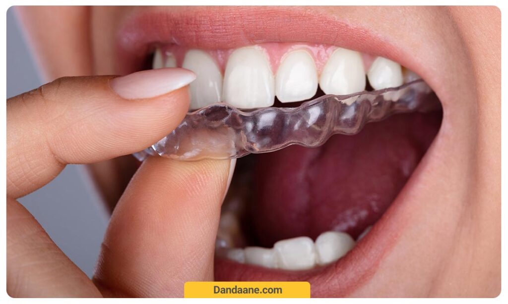 عکس ارتودنسی نامرئی اینویزیلاین